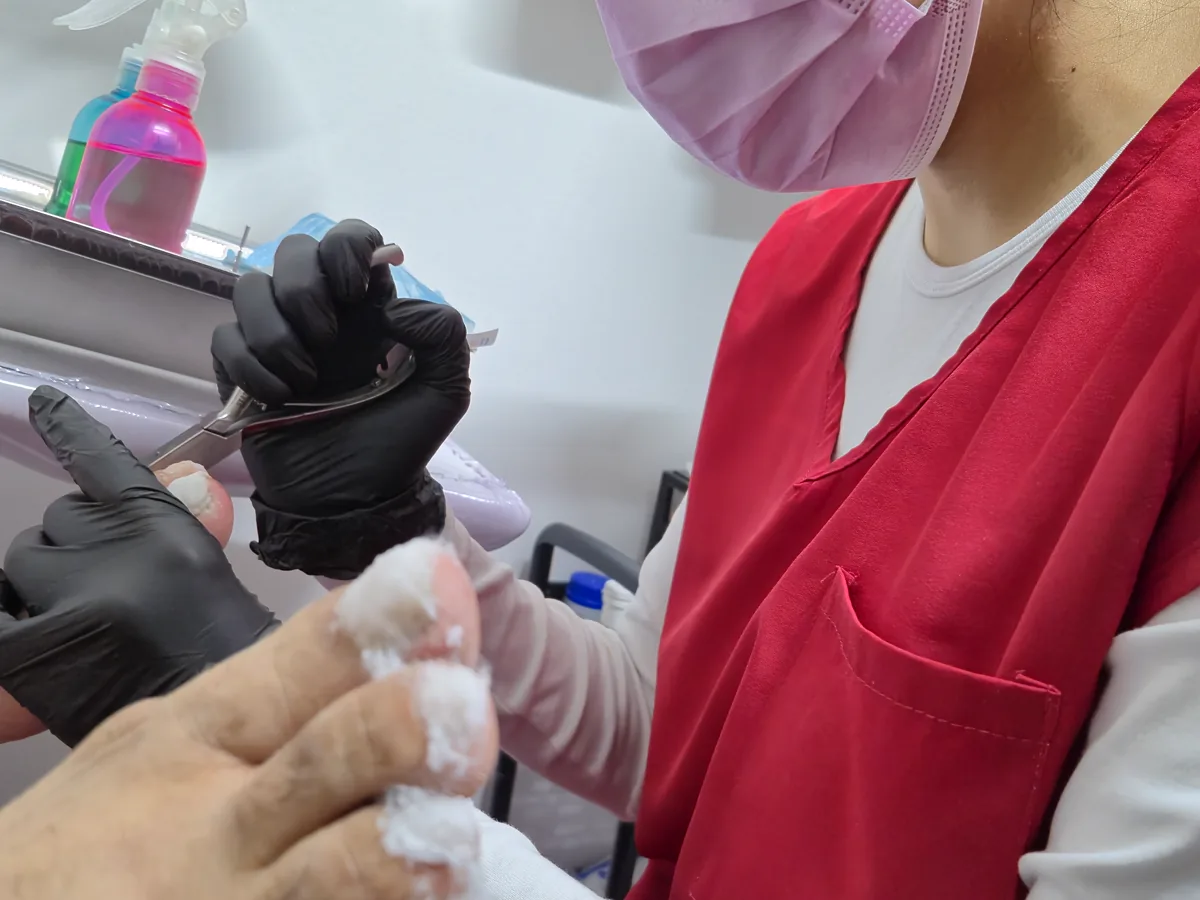 Servicio podológico real realizado en LEXIMAR